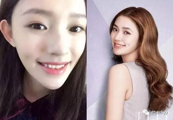 明星牙齿矫正之旅，带牙套全攻略与矫正之旅揭秘