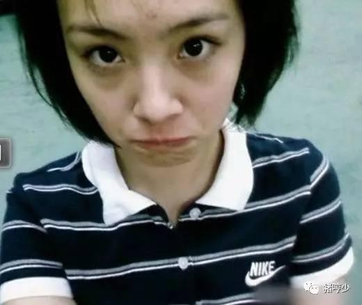 明星长痘背后的皮肤现象与时代印记观察