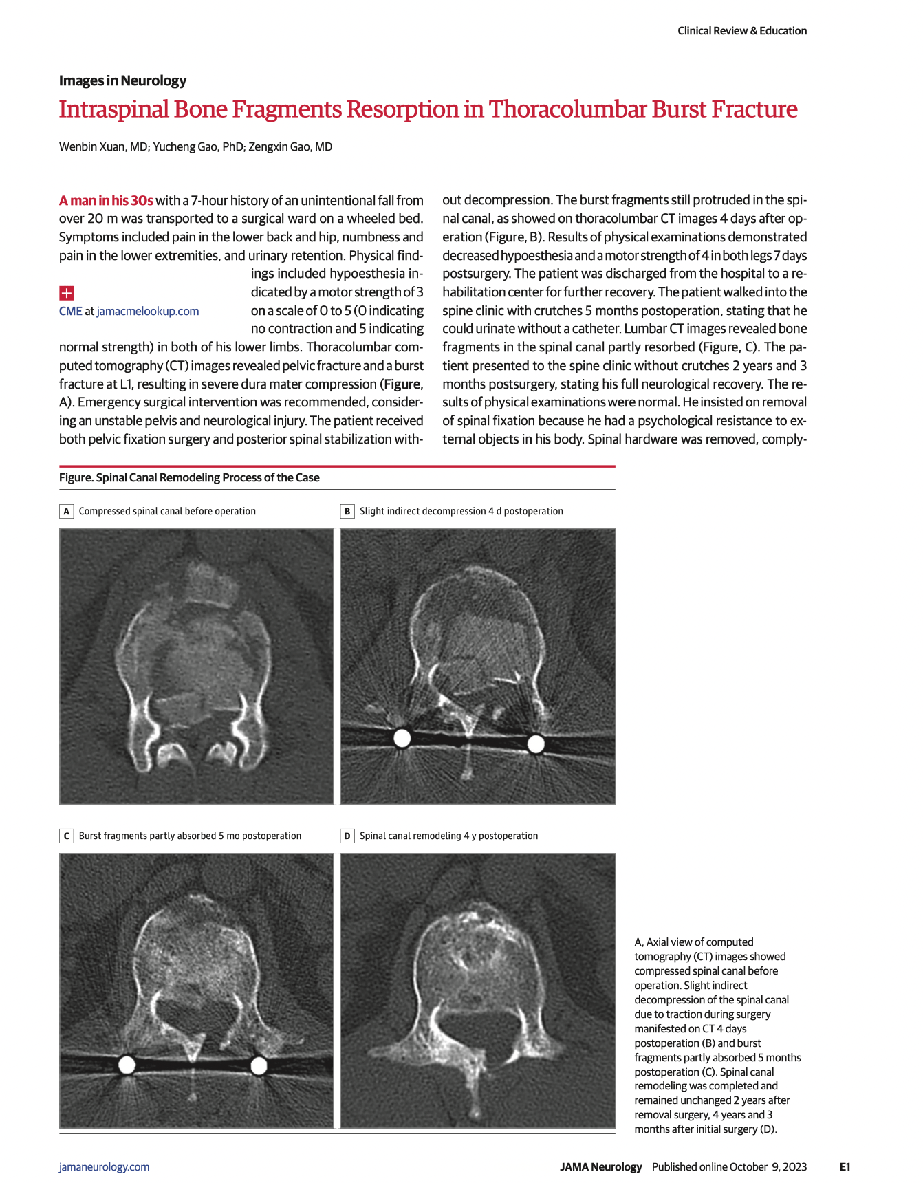 腰椎最新研究揭秘，背景、进展与影响探索之旅
